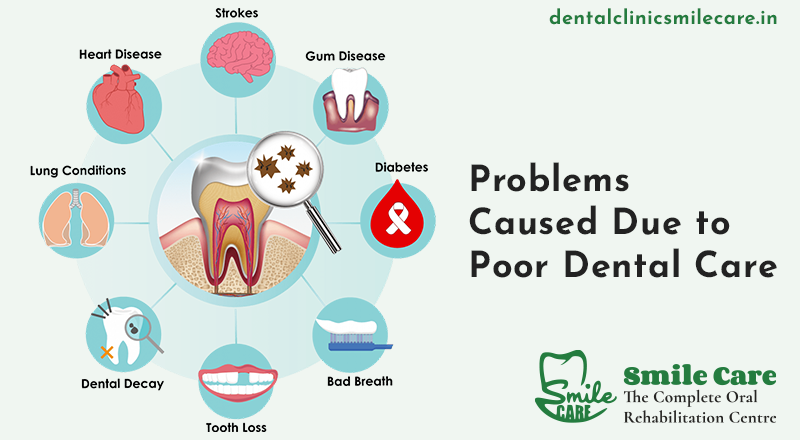 Problems Caused Due to Poor Dental Care