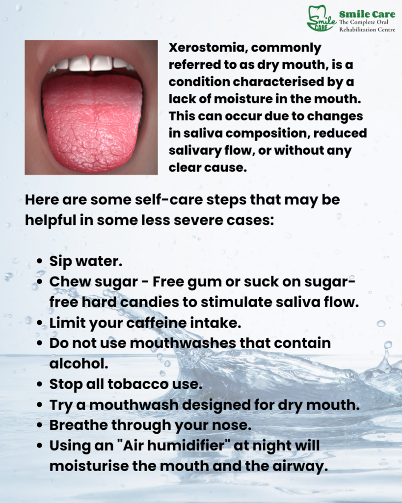 Dry Mouth - Remedy