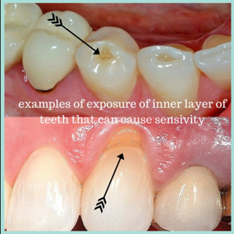 Dentine